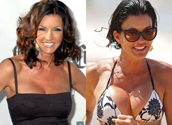 Janice Dickinson breast implants plastic surgery before and after boobs job