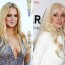 Lindsay Lohan lip injections surgery before and after augmentation photos. pictures