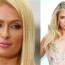 Paris Hilton nose job plastic surgery before and after Rhinoplasty photos ,