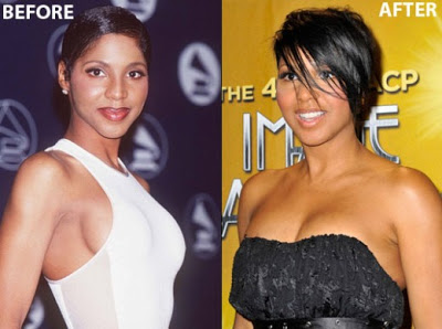 Tamar Braxton breast implants plastic surgery before and after boobs job photos
