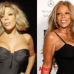 Wendy Williams plastic surgery before and after breast implants photos