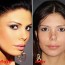 Bruna Felisberto plastic surgery disasterbefore and after pictures