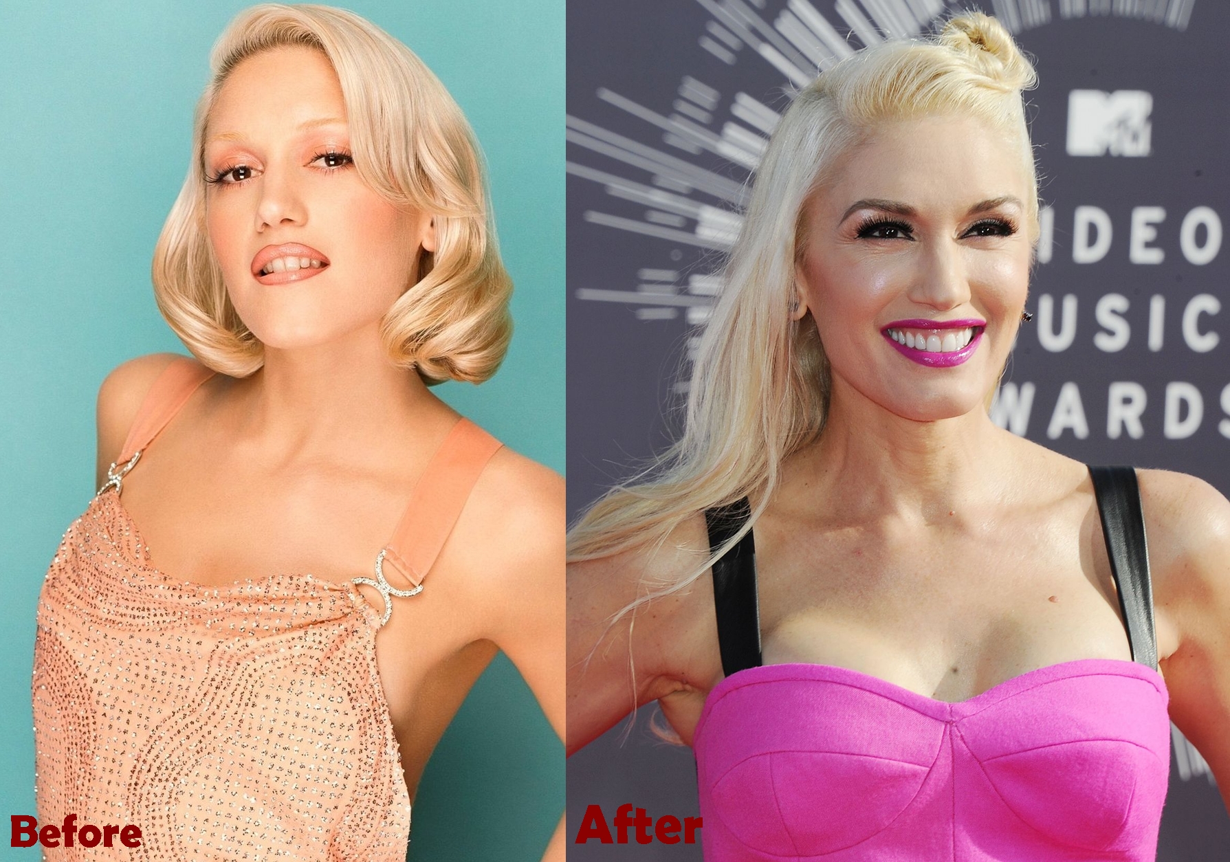 Gwen Stefani breast implants Surgery Before and After Boob Job Photos 2