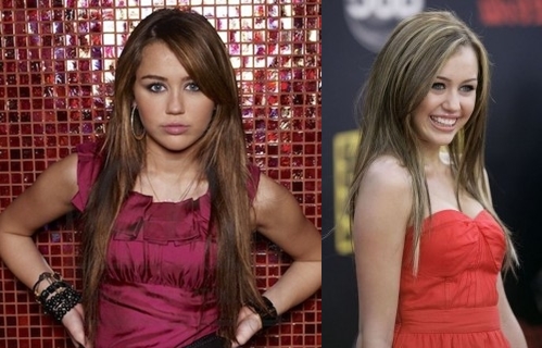Miley Cyrus breast implants surgery before and after boob job photos 2