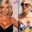 Tori Spelling plastic surgery gone wrong before and after pictures 1