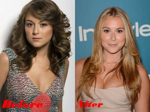 Alexa Vega breast Implants Plastic Surgery Before and After Boobs Job Photos 1