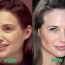 Claire Forlani Plastic Surgery Before and After Botox Photos 2