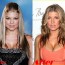 Fergie Breast implants surgery before and after boob job photos 2