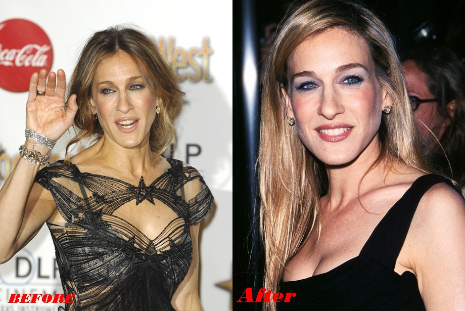 Sarah Jessica Parker breast implants before and after boob job photos 2