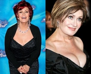 Sharon Osbourne Breast Implants Surgery Before and After Boobs Job Photos 1