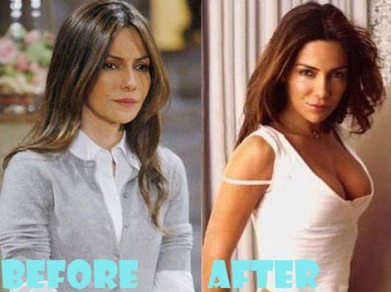 Vanessa Marcil breast implants surgery before and after boobs job 1