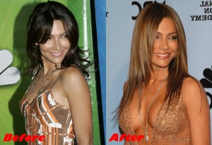 Vanessa Marcil breast implants surgery before and after boobs job 2