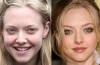 Amanda Seyfried Plastic Surgery Before And After Pictures