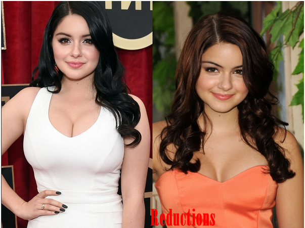 Ariel Winter Breast Implants Before And After Pictures