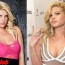 Chanel west coast plastic surgery before and after 1