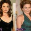 Cheryl Cole Plastic Surgery Breast Implants Before And After Photos Boobs Job 3