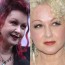 Cyndi Lauper plastic surgery before and after pictures 1