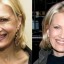 Diane Sawyer Plastic Surgery Before And After Face Photos