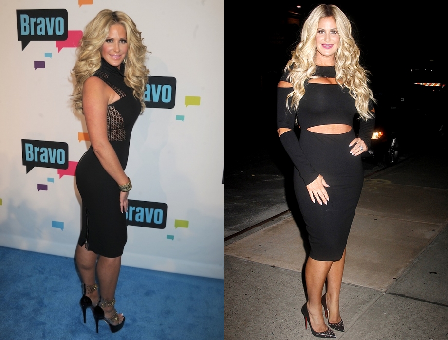 Kim zolciak Breast Implants Surgery Before and After BoobS Job Photos 2