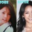 Lee Hyori plastic surgery before and after photos 1