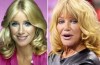 Suzanne Somers Plastic Surgery Before And After Face Photos