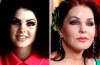 Priscilla Presley Plastic Surgery Facelift Before And After Photos