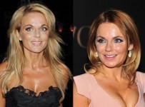 Geri Halliwell plastic surgery botox before and after face photos 1