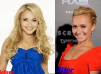 Hayden Panettiere Plastic Surgery Breast Enhancement Before And After Boobs Job 1