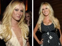 Kimberly Stewart Breast Implant Plastic Surgery Before and After Boobs Job Photos 1