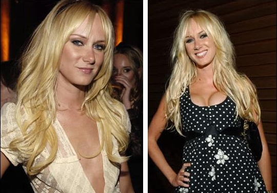 Kimberly Stewart Breast Implant Plastic Surgery Before and After Boobs Job Photos 1