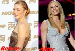 LeAnn Rimes Plastic Surgery Breast Implants Before And After Boobs Job Photos 1