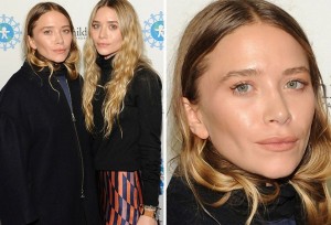 Mary Kate And Ashley Plastic Surgery Before And After Photos 1