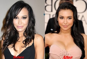 Naya Rivera Plastic Surgery Breast Implants Plastic Surgery Photos Boobs Job 1