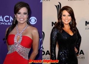 Robin Meade breast implants plastic surgery before and after boobs job photos 1