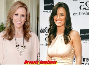 Trista Sutter Breast Implants Plastic Surgery Before and After Boobs Job Photos 1