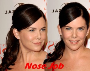 Lauren Graham Nose Job Before And After Pictures 1
