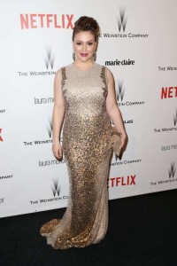 Alyssa Milano Plastic Surgery Before And After Boob Job Photos 1