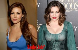 Alyssa Milano Plastic Surgery Before And After Boob Job Photos