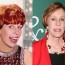 Carol Burnett Plastic Surgery Before And After