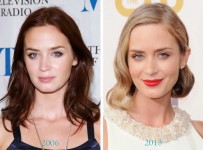 Emily Blunt Plastic Surgery Before And After Pictures 1