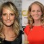 Helen Hunt Plastic Surgery Before And After Photos