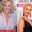 Katherine Heigl Plastic Surgery Before And After Photos 2