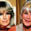 Linda Evans plastic surgery before and after pictures 2