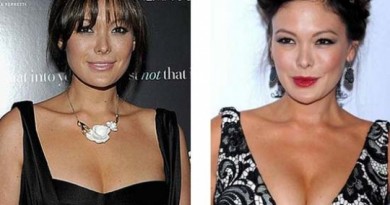 Lindsay Price Plastic Surgery Before And After Nose Job Photos 1