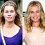 Rebecca Romijn plastic surgery before and after pictures 1
