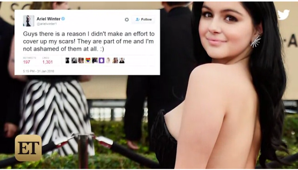 Ariel Winter Breast Implants Before And After Pictures