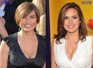 Ariska Hargitay Plastic Surgery Before And After Jaw, Breast Implants Photos 2