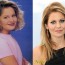 Candacecameron Plastic Surgery Before And Pictures 1