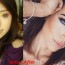 Michelle Phan Nose Job Before And After Photos