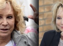 Felicity Kendal Plastic Surgery Before And After